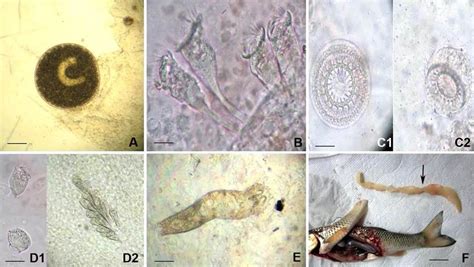  Ichthyophthirius Multifiliis: An Aquatic Parasite That Causes Shivering Among Fish and Chaos for Aquarium Enthusiasts!